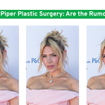 Billie Piper Plastic Surgery: Are the Rumors True?