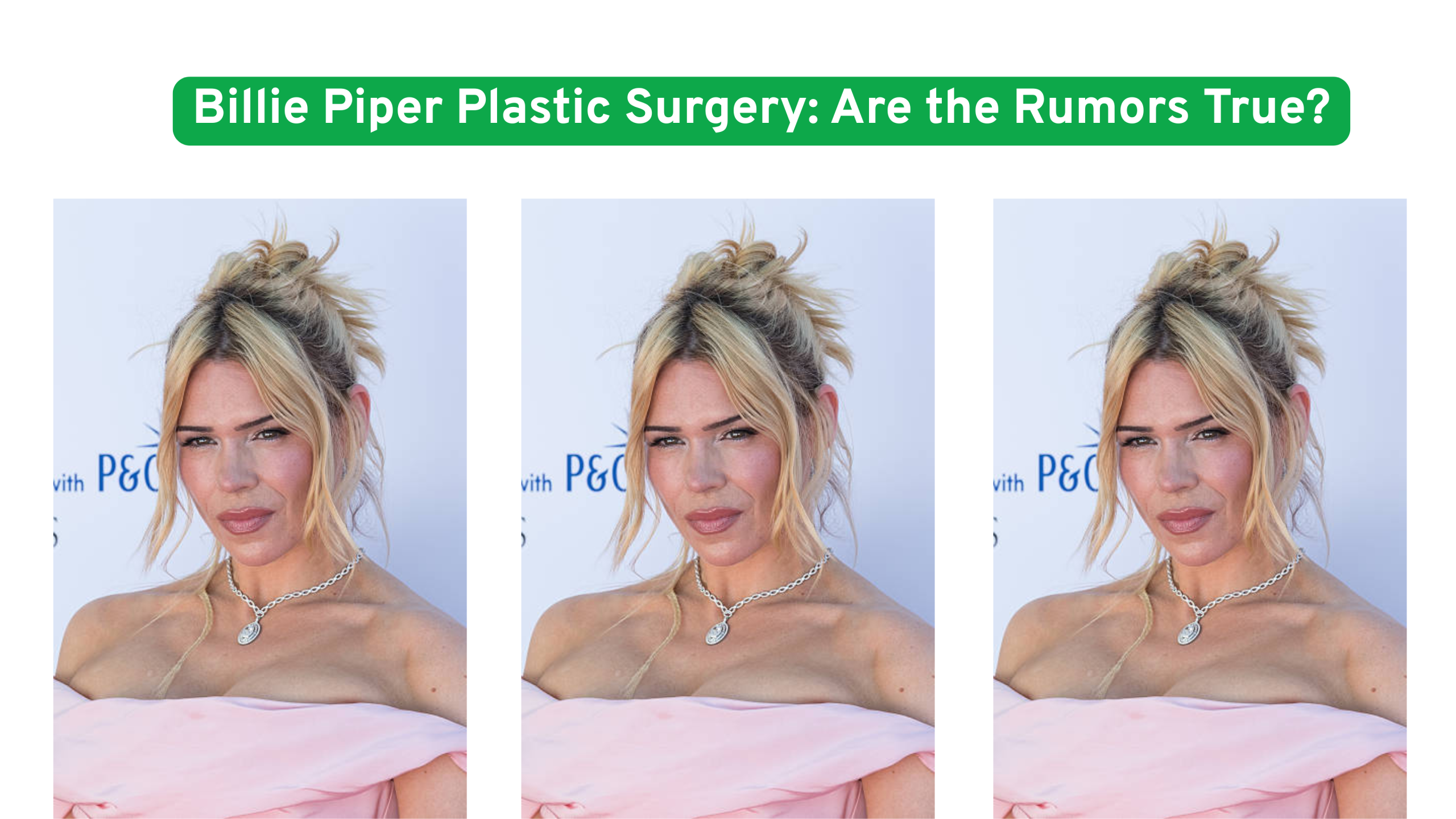 Billie Piper Plastic Surgery: Are the Rumors True?